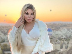 8 Transformasi Pria Dulu Mirip Boneka Ken Kini Ganti Kelamin Demi Jadi Barbie