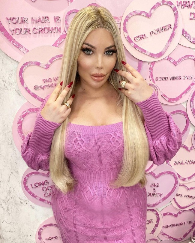 Perubahannya sebagai wanita lewat operasi plastik menelan banyak biaya. Jessica telah menghabiskan lebih dari 600 ribu poundsterling atau sekitar Rp 11 miliar untuk operasi plastik dan perawatan hormon. Foto: Instagram