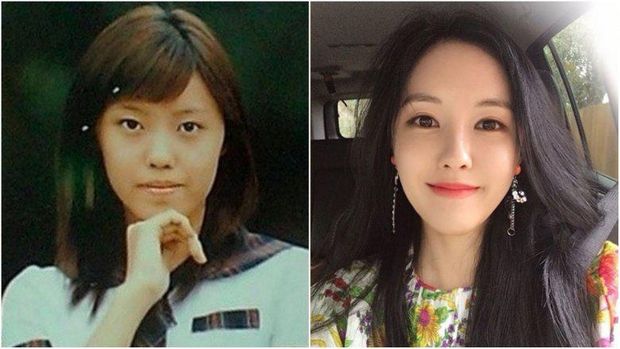 10 Artis Korea Yang Oplas Lihat Foto Sebelum Dan Sesudahnya Halaman 2 