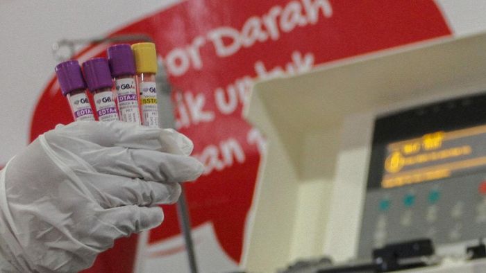 Bantu Sembuhkan Pasien COVID-19, Begini Cara Kerja Terapi Plasma Konvalesen Terapi plasma konvalesen menjadi salah satu metode penyembuhan pasien COVID-19. Seperti apa cara kerja terapi plasma konvalesen ini?
