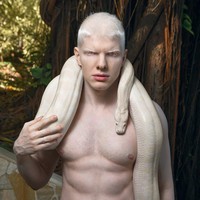 Tak hanya wanita, ada beberapa model pria yang dianggap mendobrak standar kecantikan, salah satunya Bera Ivanishvili. Penyanyi dan model tersebut dengan bangga menjadi perwakilan mereka yang mengidap albino. Foto: Instagram @beraofficial