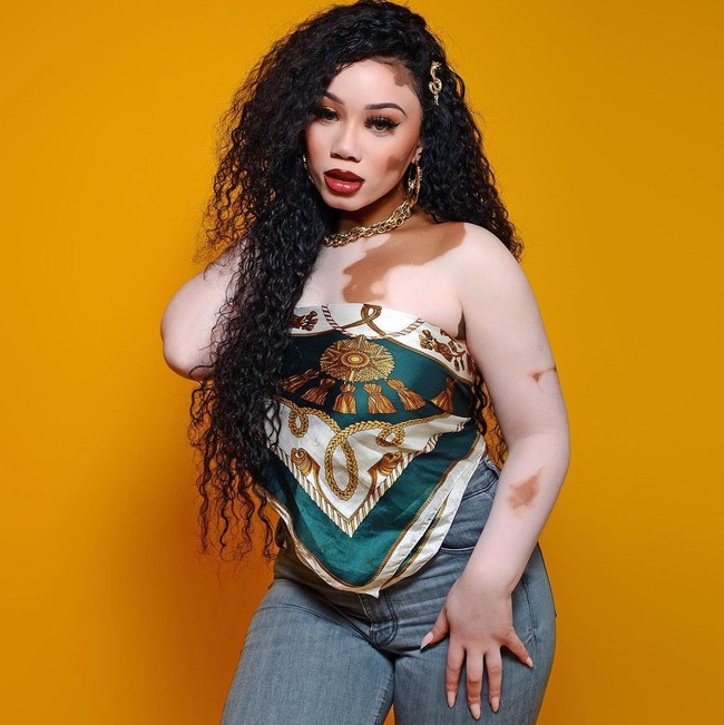 Cukup banyak model dengan kondisi kulit langka di industri fashion. Salah satunya adalah Deborah Moreno. Deborah yang mengidap vitiligo menunjukkan jika keunikannya adalah kecantikannya. Foto: Instagram @deborahmoreno1