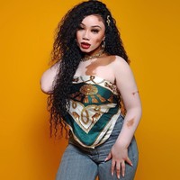 Cukup banyak model dengan kondisi kulit langka di industri fashion. Salah satunya adalah Deborah Moreno. Deborah yang mengidap vitiligo menunjukkan jika keunikannya adalah kecantikannya. Foto: Instagram @deborahmoreno1