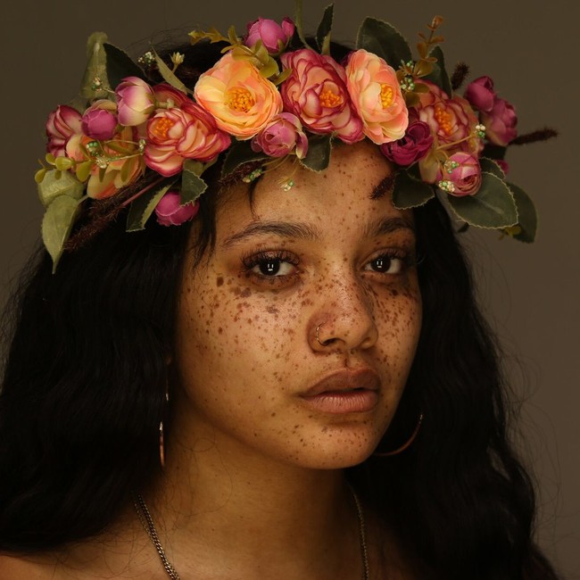 Melody Mikél tampil cantik secara natural dengan bintik-bintik yang ada di wajahnya. Ia menjadi inspirasi bagi banyak orang untuk menerima keunikan mereka sendiri. Foto: Instagram @melmikel