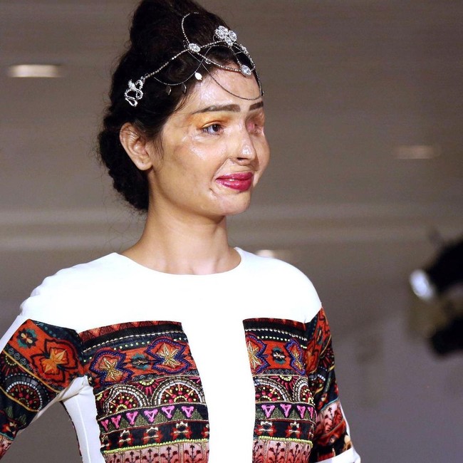 Reshma Qureshi adalah korban air keras yang menjadi vlogger, aktivis, dan model. Wanita asal India itu sering berbagi inspirasi bahwa kecantikan datang dalam banyak bentuk. Foto: Instagram @beingreshma