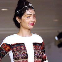 Reshma Qureshi adalah korban air keras yang menjadi vlogger, aktivis, dan model. Wanita asal India itu sering berbagi inspirasi bahwa kecantikan datang dalam banyak bentuk. Foto: Instagram @beingreshma