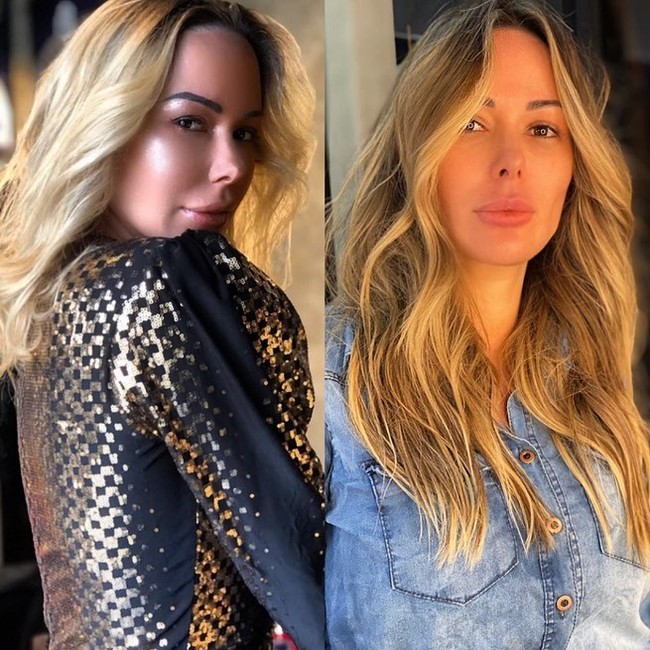 Dilansir Daily Star, Ju Isen telah menjalani dua operasi besar yakni empat kali liposuction dan tiga kali penggantian silikon. Ia juga melakukan tindakan yang dinamakan facial harmonisation dan perawatan hyaluronic acid serta methacryl di wajahnya. Ia pun pernah menyuntikkan lemak di bokong dan pipi. Foto: Instagram