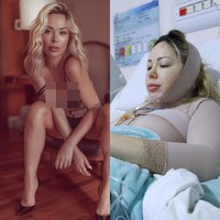 Baru-baru ini Ju Isen mengungkap bahwa ia telah menjalani kurang lebih 50 prosedur operasi plastik. Awalnya ingin mengubah diri untuk menjadi sosok baru, Ju Isen mengaku akhirnya itu menjadi candu. Foto: Instagram