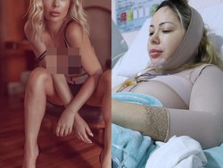 Penampilan Model Playboy yang Kecanduan Operasi Plastik, Habiskan Rp 4,2 M