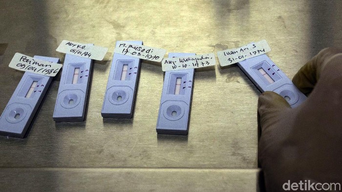 Ada Laboratorium Mini untuk Tes Swab Antigen Pegawai di BPKP Badan Pengawasan Keuangan dan Pembangunan (BPKP) hadirkan laboratorium mini-layanan tes swab antigen bagi para pegawai. Hal itu dilakukan guna cegah COVID-19.