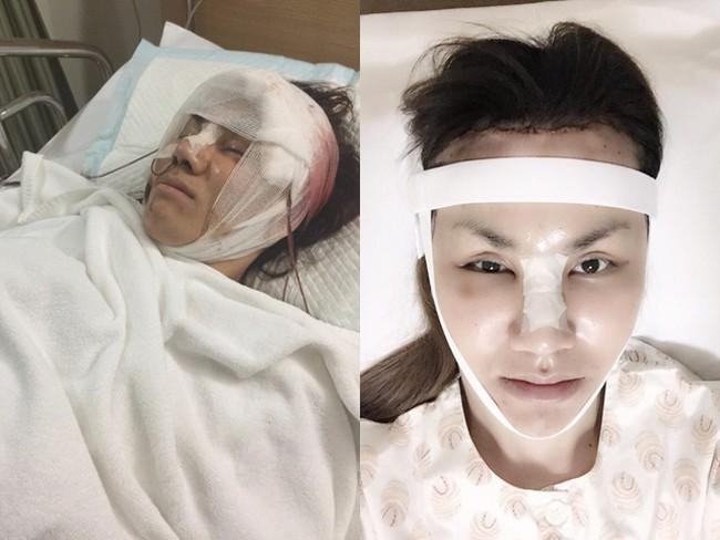 Bow sempat mengumpulkan uang dari hasil kerjanya, namun sayang ternyata dia ditipu oleh mantan kekasihnya. Hal itu membuat kondisi perekonomian Bow jadi terpuruk. Namun dia tetap tak patah semangat. Dia kemudian kembali mencari pekerjaan dengan gaji yang bagus dan mengumpulkan uang untuk melakukan operasi plastik. Foto: eva.vn