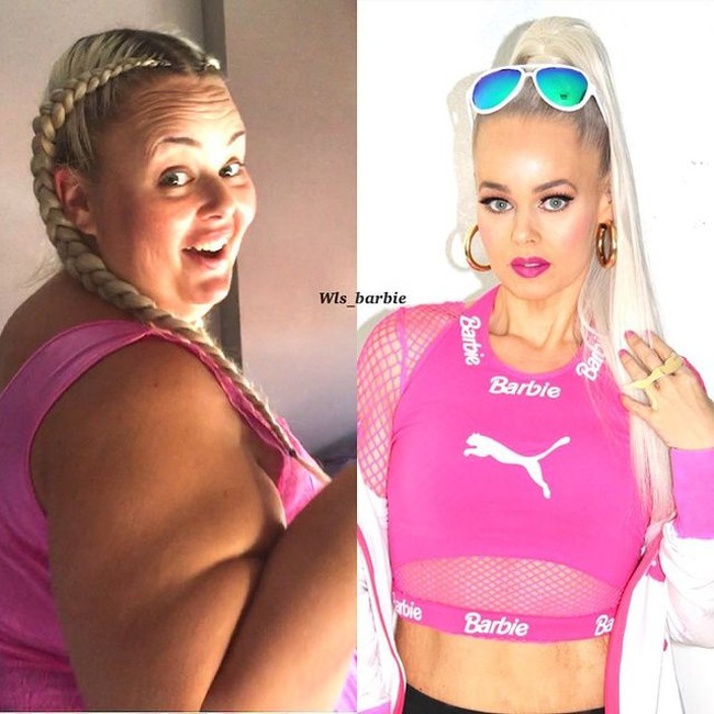 Kayla mengatakan bahwa walaupun operasi lambungnya itu membantu mengecilkan porsi perutnya tetapi itu tidak menyelesaikan segala masalahnya. Dia tetap harus berusaha keras untuk memperoleh bentuk tubuh yang dinginkannya. Kayla juga mengurangi asupan karbohidrat, gula, dan makanan cepat saji. Foto: Instagram/@wls_barbie