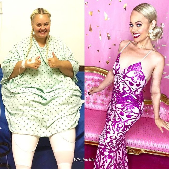 Seorang wanita yang berasal dari Sydney dan saat ini tinggal di Las Vegas berhasil menurunkan berat badannya sebanyak 90 kg. Penampilannya kini jadi berubah drastis dan lebih langsing. Foto: Instagram/@wls_barbie