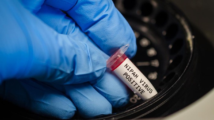 962736840 Scientist analyzing nipah virus positive blood sample