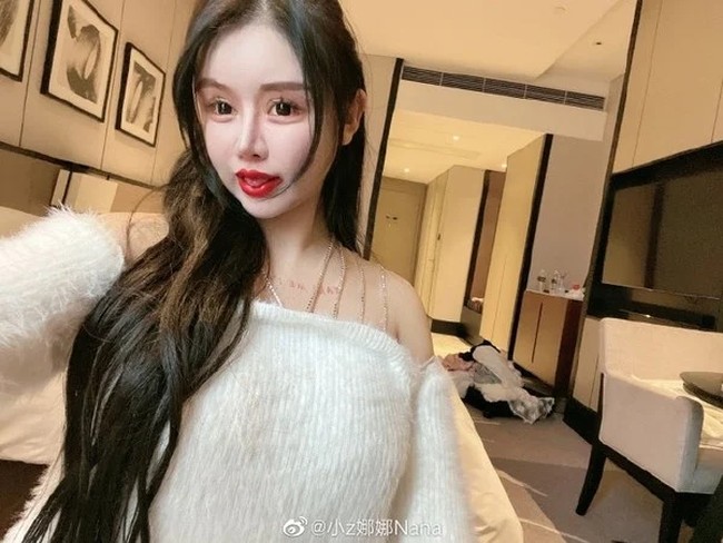 Selain ingin secantik artis, Zhou Chuna memang mengalami kecemasan dengan penampilan sejak kecil. Dikatakan jika sejak sekolah, wanita itu sering merasa depresi dan tidak nyaman ketika teman juga keluarga mengatakan ia tidak mirip ibunya yang cantik. Foto: Weibo