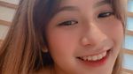 7 Potret Novia Salim, Selebgram yang Alami Kekerasan dalam Pacaran