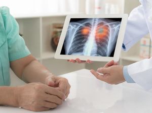 Viral Tes Kesehatan Paru dengan Tahan Napas, Ini Penjelasan Dokter