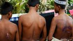 Melihat Lagi Derita Muslim Rohingya Myanmar