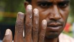Melihat Lagi Derita Muslim Rohingya Myanmar
