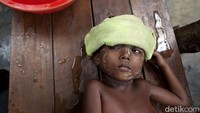 Terlihat seorang anak Rohingya antri dalam pengobatan di sebuah klinik di negara bagian Arakan, Myanmar , (4/5/ 2009). Mayoritas pasien yang dirawat adalah minoritas Muslim Rohingya yang tinggal di lingkungan Muslim di Sittwe.  Paula Bronstein / Getty Images)