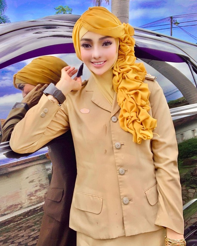 Dia juga mengungkapkan kisah di balik dagunya yang sangat lancip. Dia mengaku dagu lancip dan pipi tirusnya hasil dari perawatan di klinik kecantikan. Dagu aku memang lancip dan pipi juga tirus karena aku sering ke klinik kecantikan sekitar empat tahun lalu. Aku mencoba perawata wajah pada umumnya seperti tarik benang, filer dan lainnya, tutur wanita yang tinggal di Bandar Lampung itu. Foto: Instagram @yuni_jasminebutiq.