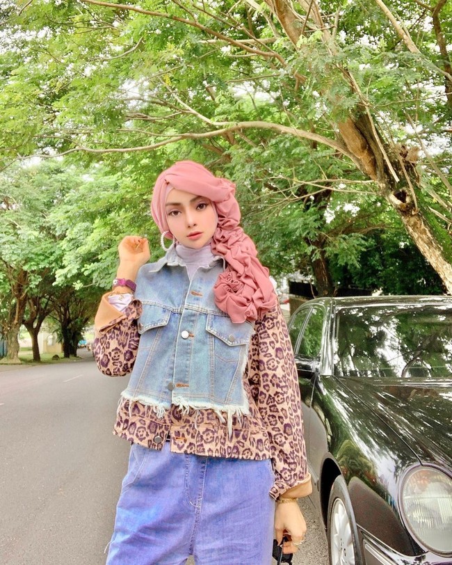 Dalam kesehariannya, Yuni yang merupakan ibu dari tiga anak itu bekerja sebagai pegawai. Dia juga memiliki butik pakaian di Bandar Lampung. Aku jual baju-baju, aksesori, hijab-hijab lucu. Aku membuka butik sejak 2008, terus vakum beberapa tahun, aku buka lagi pada 2014 sampai sekarang, lanjut wanita 42 tahun itu. Kemudian Yuni Jasmine kembali viral usai berbincang dengan dr. Richard Lee mengenai berbagai prosedur yang dilakukannya.  Foto: Instagram @yuni_jasminebutiq.