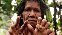 Yosina Logo menunjukkan tangannya. Kebanyakan ruas jarinya telah terpotong dalam tradisi iki palek