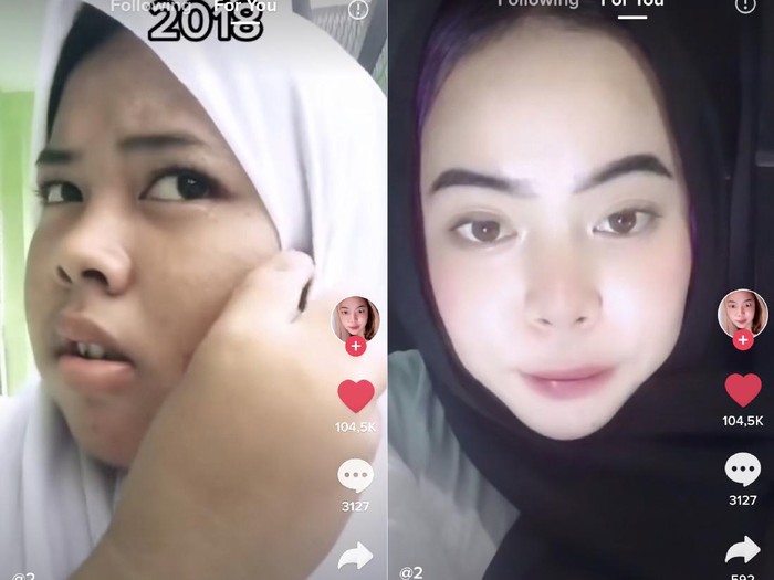 Septi Rizma Kartika yang berhasil glow up. Septi Rizma Kartika yang berhasil glow up.