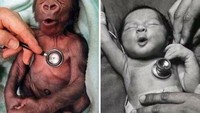 Ekspresi gorila dan bayi saat ditempelin stetoskop. Gemas!
