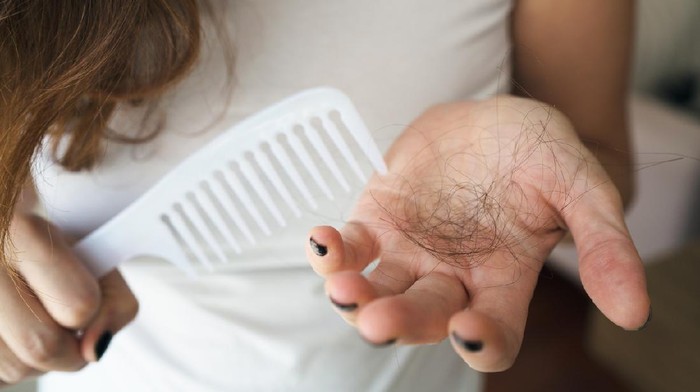 Rambut rontok Woman losing hair on hairbrush in hand
