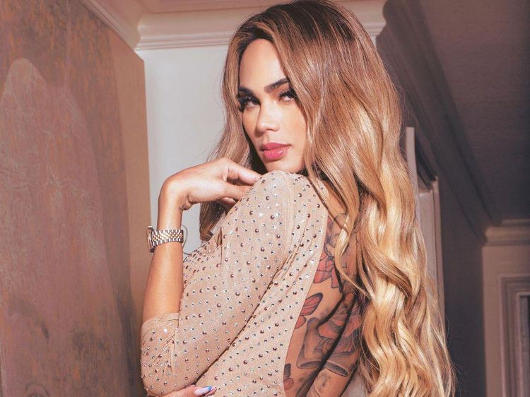 8 Penampilan Model yang Operasi Plastik 50 Kali, Wajahnya Dulu Beda Banget