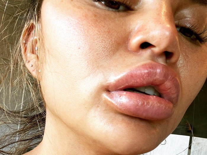 Chrissy Teigen Chrissy Teigen