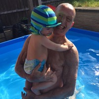 Daniel telah melakukan berbagai prosedur kecantikan untuk mengembalikan kulitnya yang sebelumnya meleleh. Dia telah melakukan cangkok kulit hingga melakukan prosedur meletakkan pigmen di kulit kepalanya sehingga tampak seperti rambut.  Foto: Instagram