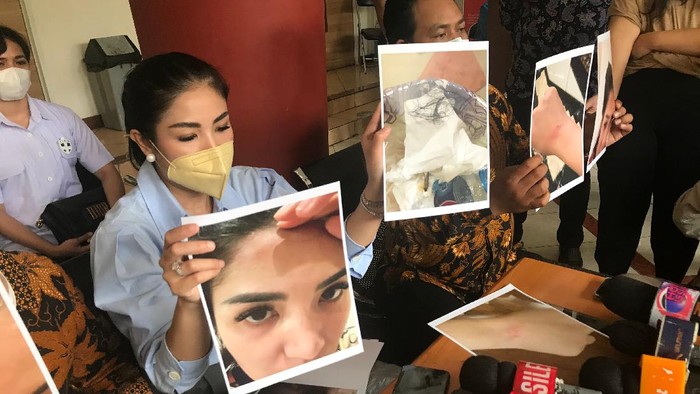 Nindy Ayunda datangi Komnas Perempuan, tunjukan bukti KDRT