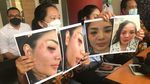 Nindy Ayunda Tunjukkan Bukti KDRT, Luka Lebam hingga Rambut Rontok