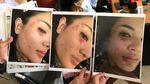 Nindy Ayunda Tunjukkan Bukti KDRT, Luka Lebam hingga Rambut Rontok