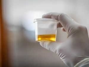Wanita Pakai Urine untuk Kempiskan Jerawat Jadi Viral, Dokter Ungkap Bahayanya