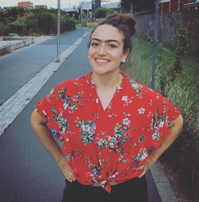 Eldina pun meminta orang-orang yang merasa memiliki perbedaan agar tidak ambil pusing dengan standar kecantikan yang sudah terlanjur terbentuk. Foto: Instagram/ @eldina_jaganjac