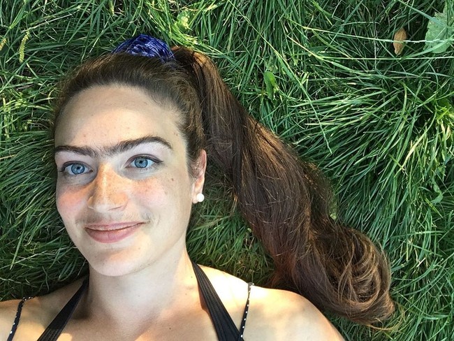 Setelah bisa menerima kondisi dan lebih percaya diri, Eldina kini ingin mendorong orang agar tidak memiliki banyak kekhawatiran tentang penampilan.  Foto: Instagram/ @eldina_jaganjac