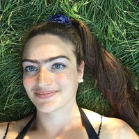 Setelah bisa menerima kondisi dan lebih percaya diri, Eldina kini ingin mendorong orang agar tidak memiliki banyak kekhawatiran tentang penampilan.  Foto: Instagram/ @eldina_jaganjac