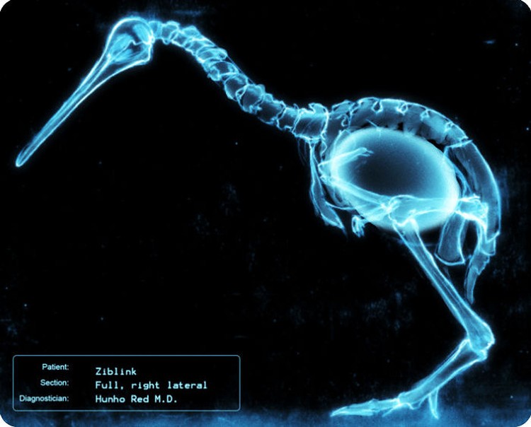 Foto X-Ray