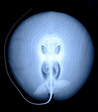 Foto X-Ray