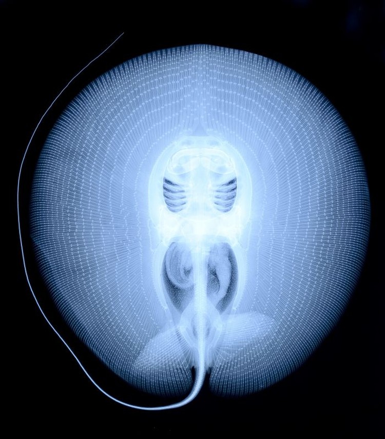 Foto X-Ray