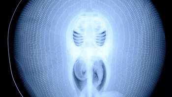 X-Ray ikan pari. Foto: doc Bored Panda
