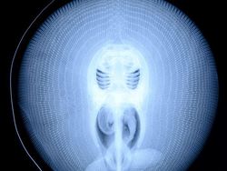 Deretan Foto X-Ray yang Mungkin Belum Pernah Kamu Lihat