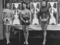 Foto X-Ray