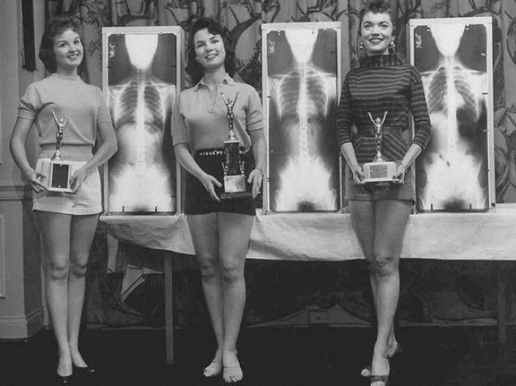 Foto X-Ray