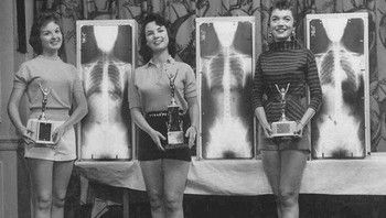 Dahulu pernah ada kontes postur dengan melihat hasil X-Ray. Foto: doc Bored Panda