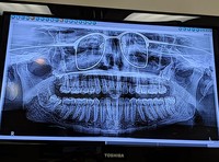Foto X-Ray