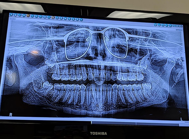 Foto X-Ray